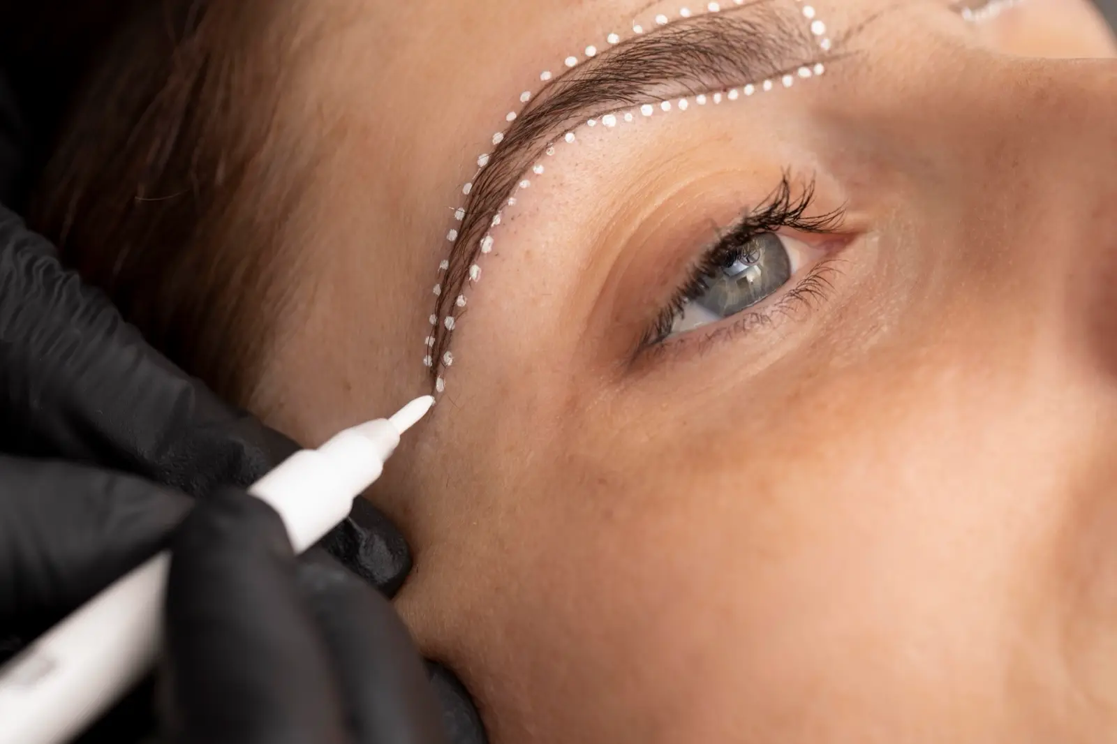 Close-up of a woman’s eyebrow being marked with a dotted design before an eyebrow transplant