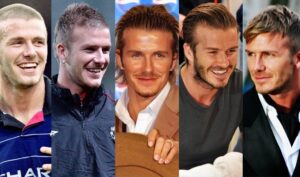 David Beckham Hair Transplant