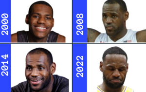 Hair loss Lebron James