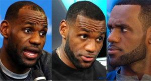 Lebron James hair transplant before after