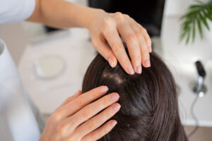 Doctor checking hair scalp