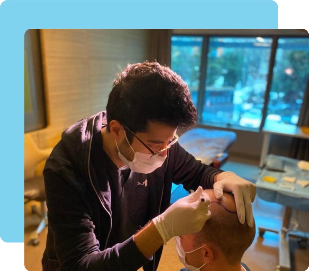 FUE Hair Transplant in Turkey Treatment 1